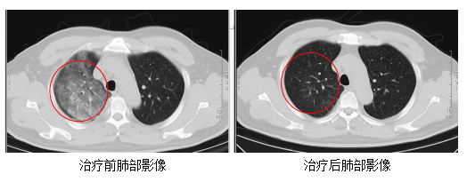 江苏出现罕见人畜共通传染病 网友忧成新冠2.0