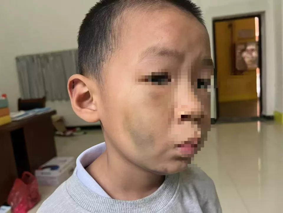 7岁男童被长期虐待?生父被刑拘