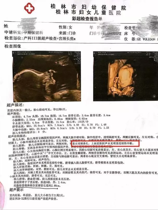 女子稱彩超漏診嬰兒唇裂 到衛健委反映竟遭怒斥