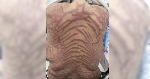 駭人：南京女子狂擦「萬能神葯」！身上長滿...