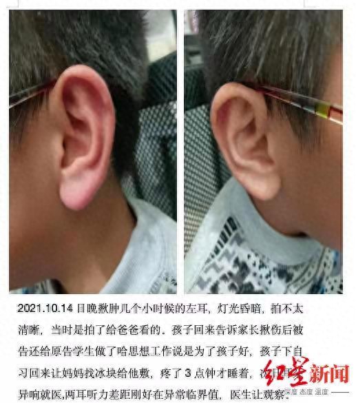 家长称初一学生遭班主任踢打吐口水后患心理疾病