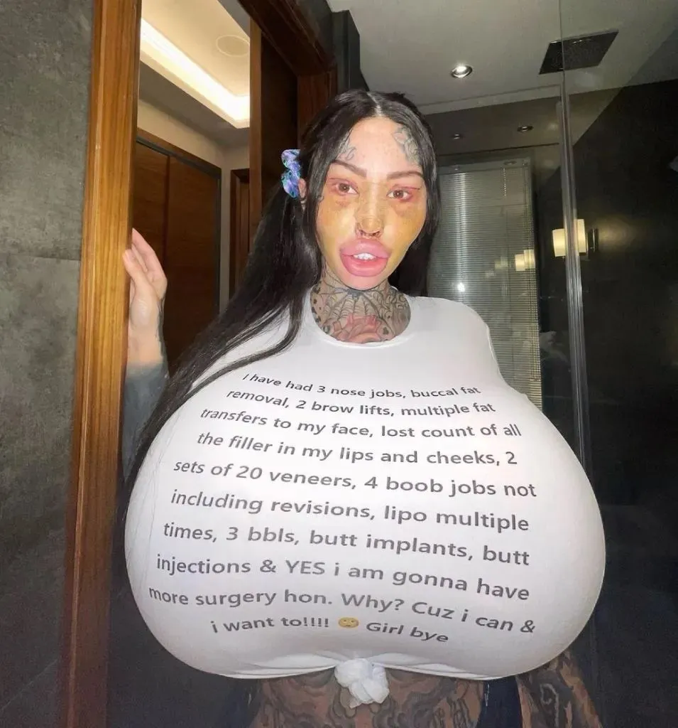 把胸隆炸的網紅猝逝!網疑自殺 死前已成外星人