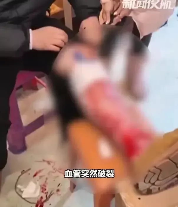 南方人游哈尔滨 -20℃血管冻裂 鲜血狂喷落地成冰
