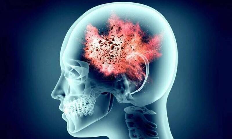 1/3人脑中有寄生虫？研究揭人体“自毁开关”