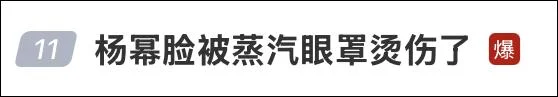 杨幂脸被蒸汽眼罩烫伤上热搜 很多人都在用