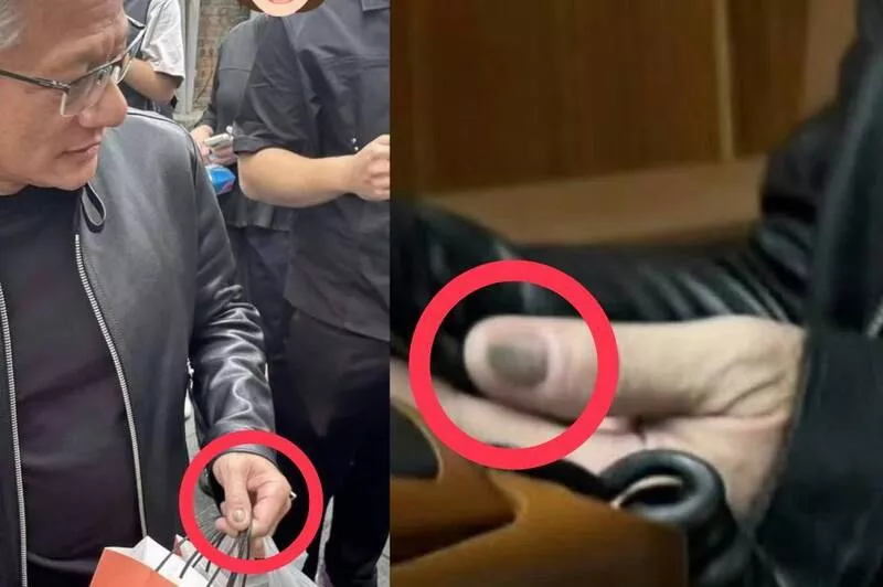 黄仁勋“灰色指甲”引百万人关注 皮肤科医生解读