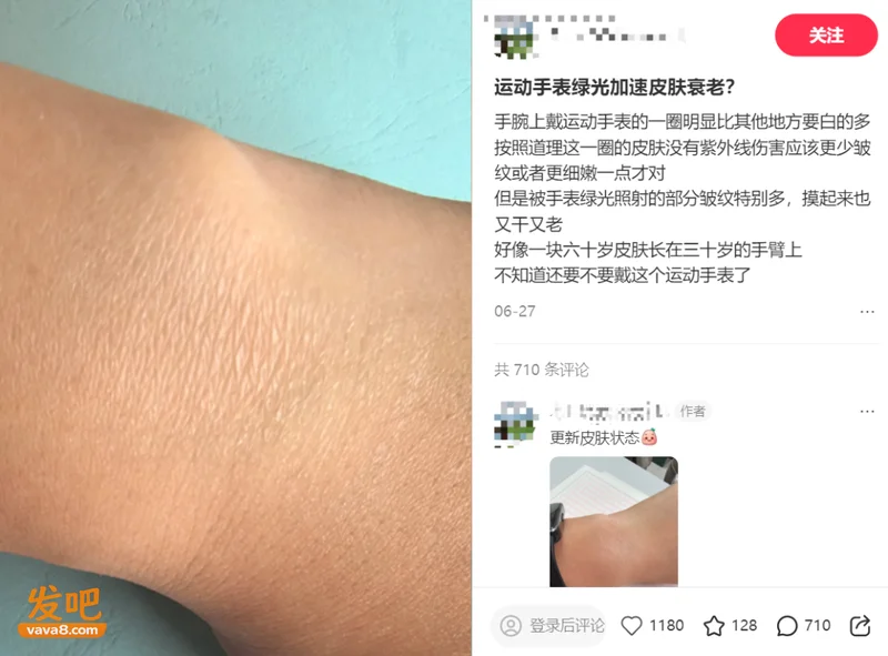 第一批戴运动手环的“受害者”出现了…