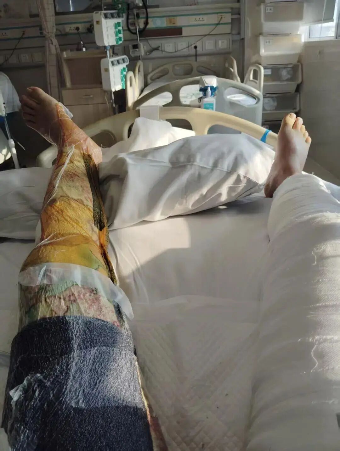 太惨痛！加油时一个举动 男子驶离15分钟后起火…