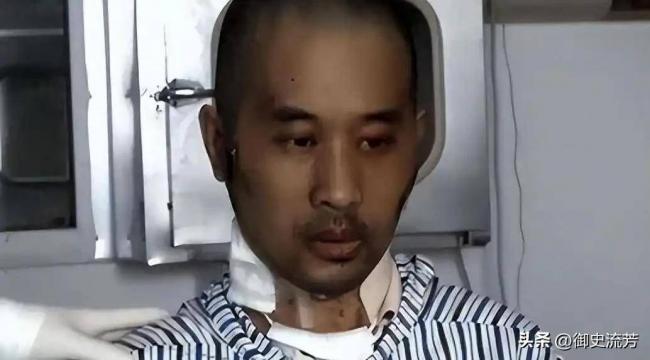 武汉首批新冠重症幸存者，6年后现状如何
